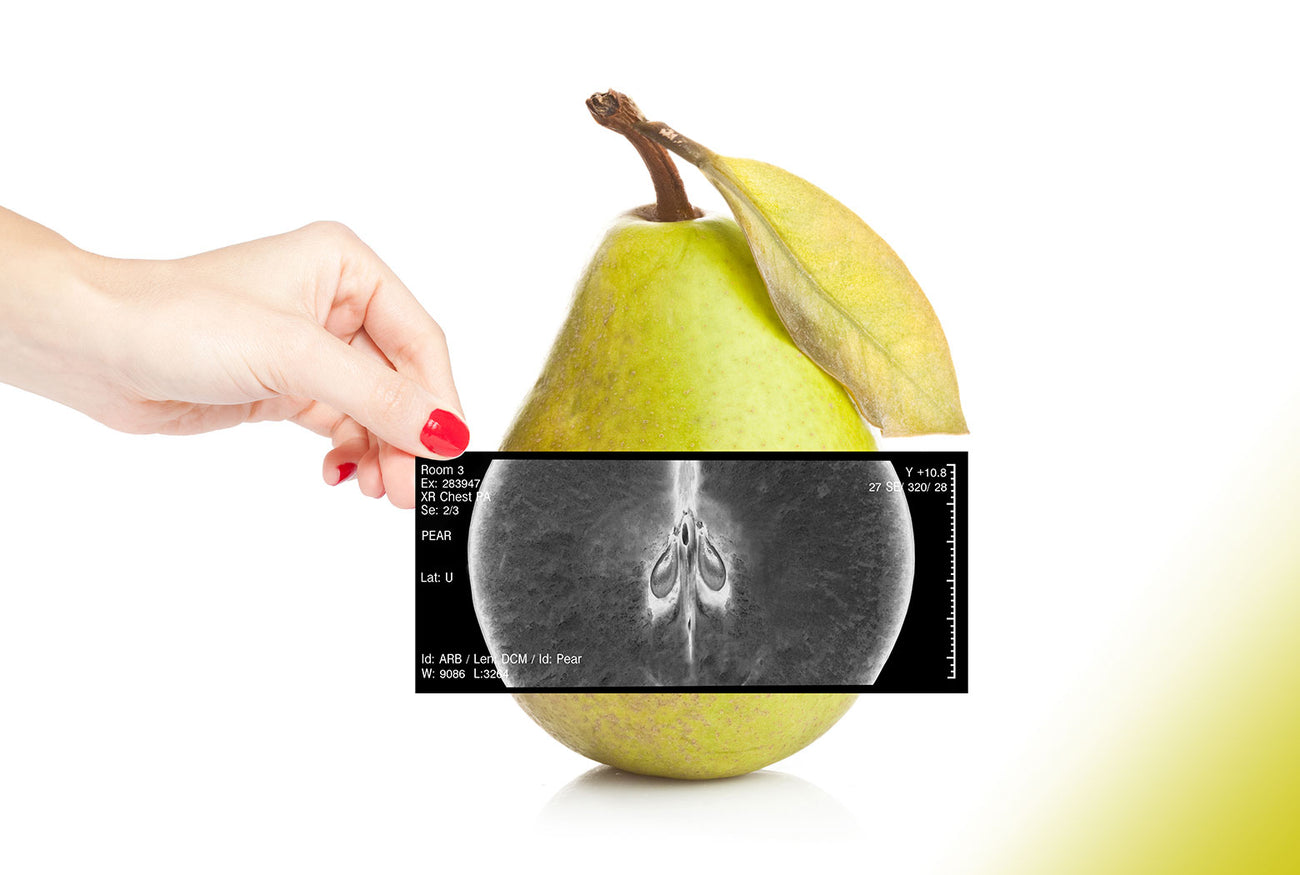 2D Röntgensysteme, 2D Röntgen, 2D