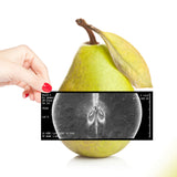 2D Röntgensysteme, 2D Röntgen, 2D